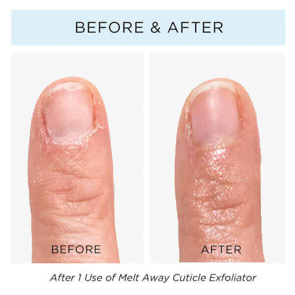 Cuticle Care