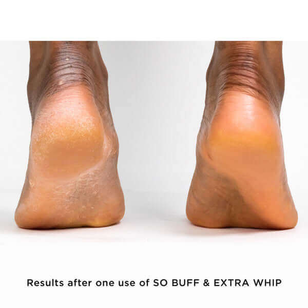 Buff Feet: Tweezerman Pedro Callus Stone and a Foot-Smoothing Secret -  Beautygeeks